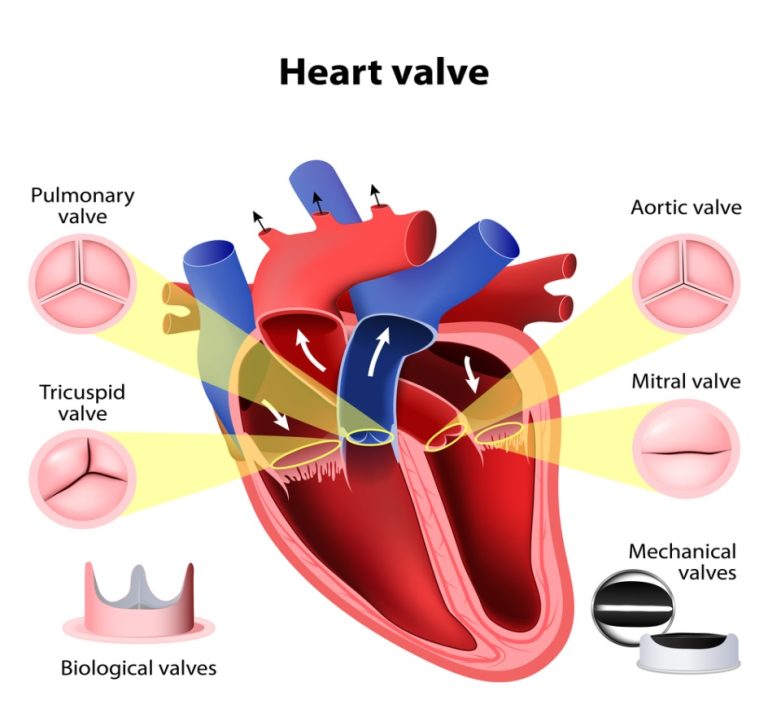 mitral-valve-disorders-victory-brokerage-inc-helping-agents-write